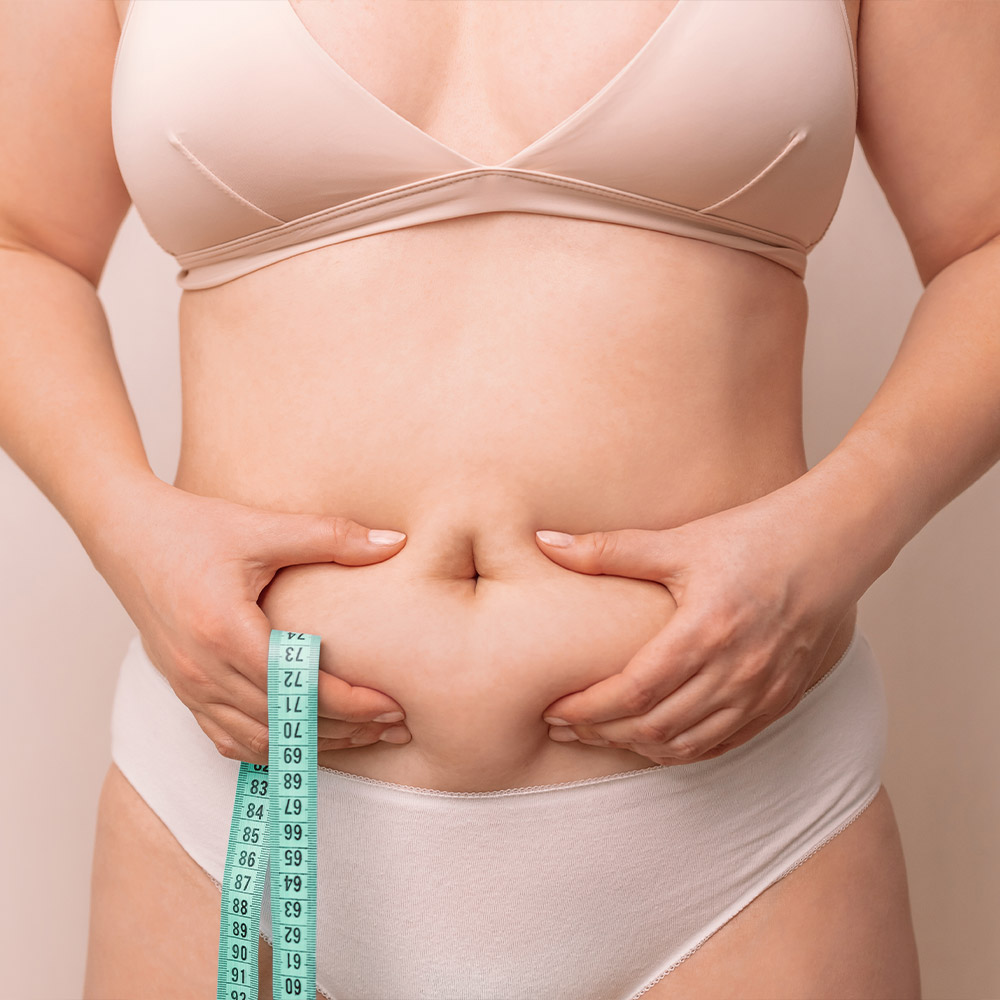 Lipoplastia